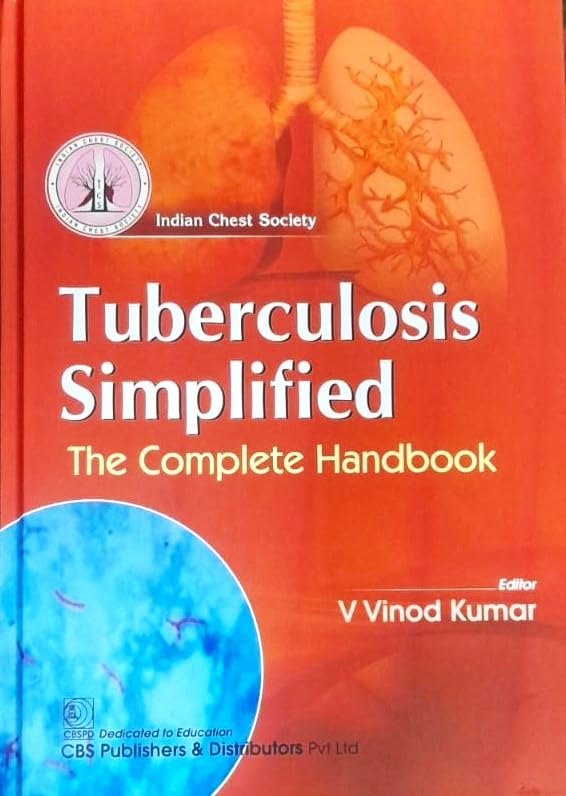 TUBERCULOSIS SIMPLIFIED THE COMPLETE HANDBOOK (HB 2024) [Hardcover] V Vinod Kumar