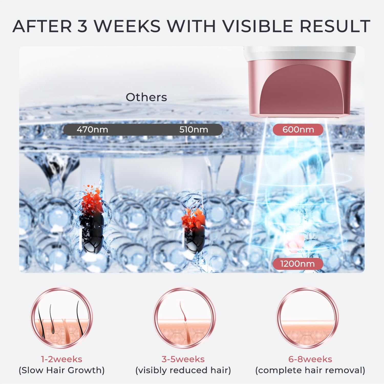 Laser Hair Removal Device