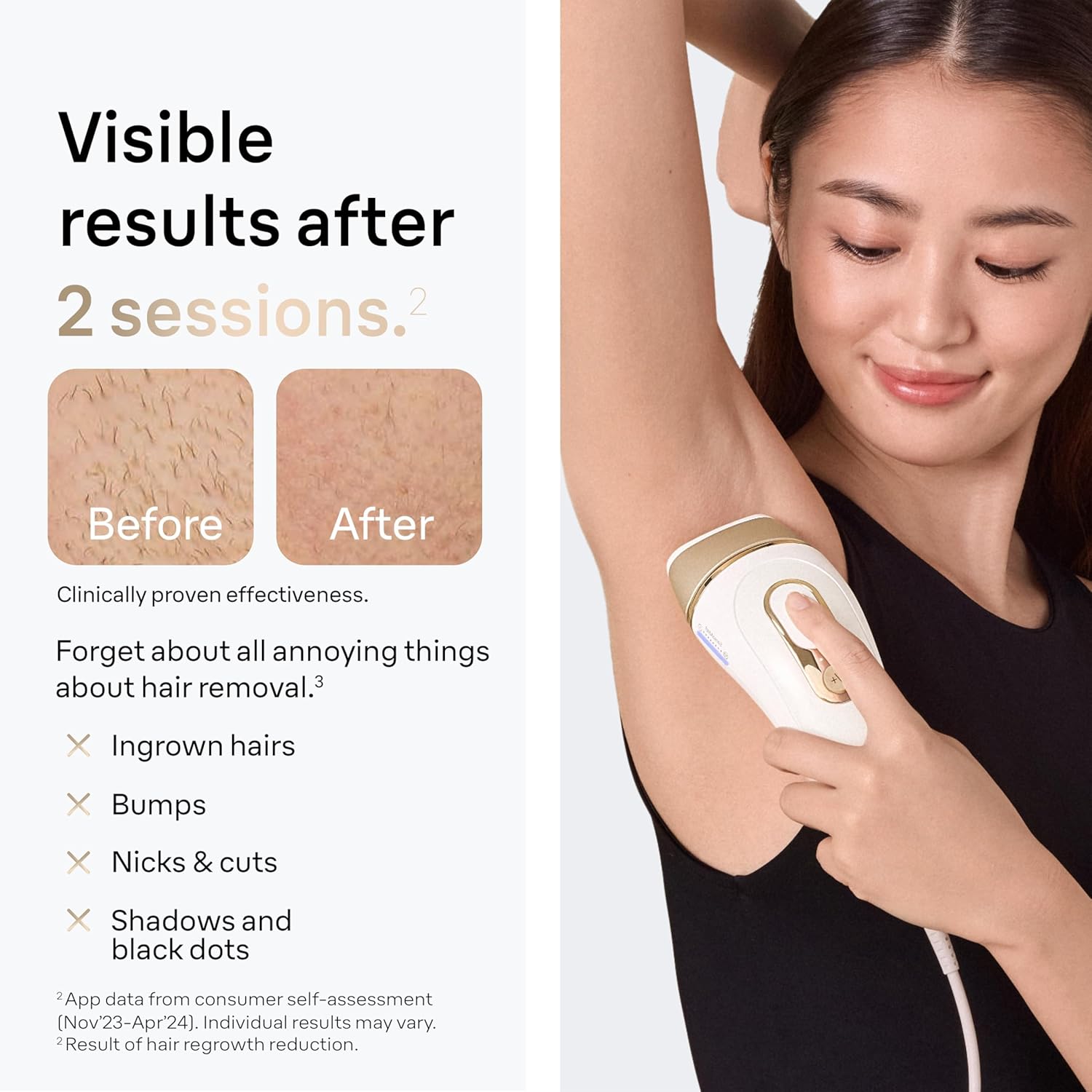 Braun IPL Silk·Expert Pro 5 PL5157